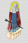 Flexor corto de los dedos